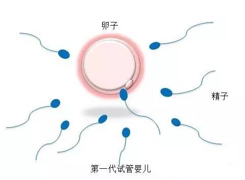 男性因素